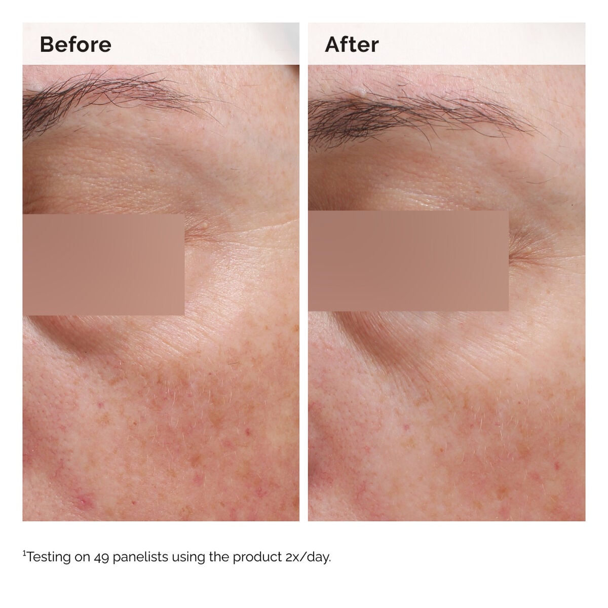 niacinamide-5-face-and-body-emulsion-j0 2024-08-23-ORD-Nia-5pct-Face-Body-B-A-Elasticity-Global-02-1x1.jpg