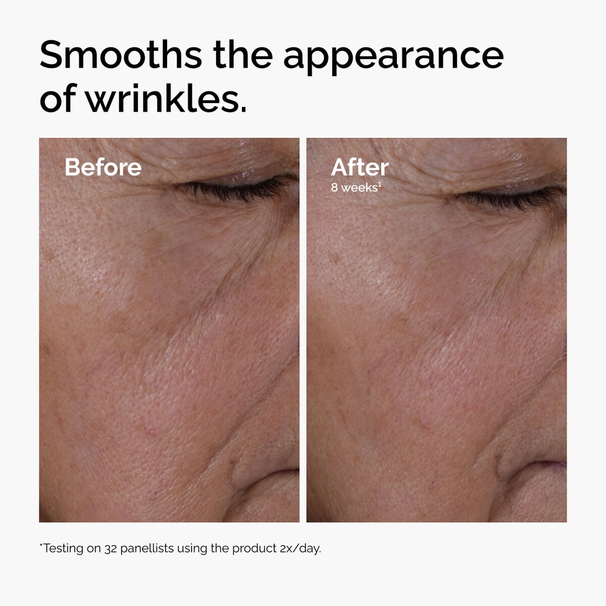 multi-peptide-ha-serum-f3 ord-multi-peptide-ha-serum-wrinkles-before-after.jpg