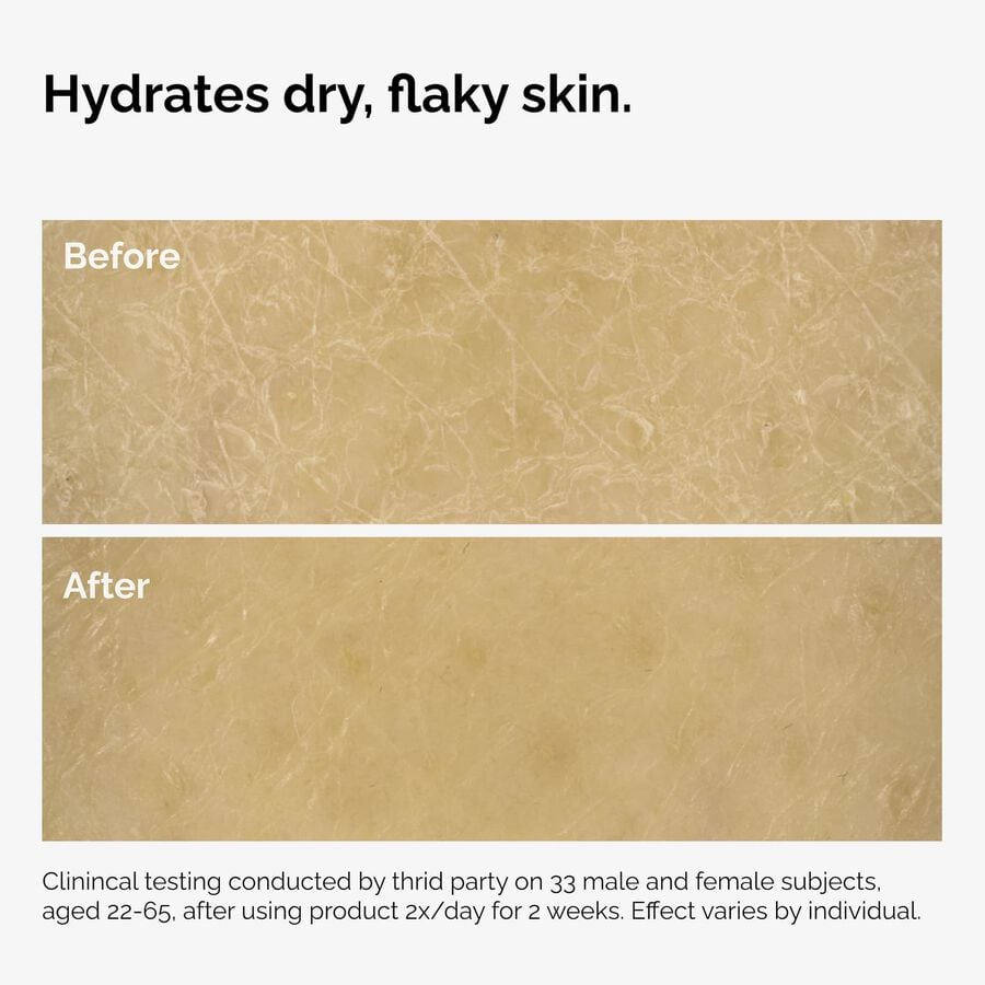 the-body-care-collection-u9 ord-natural-moisturizing-factors-inulin-body-before-after-graphic-02.jpg