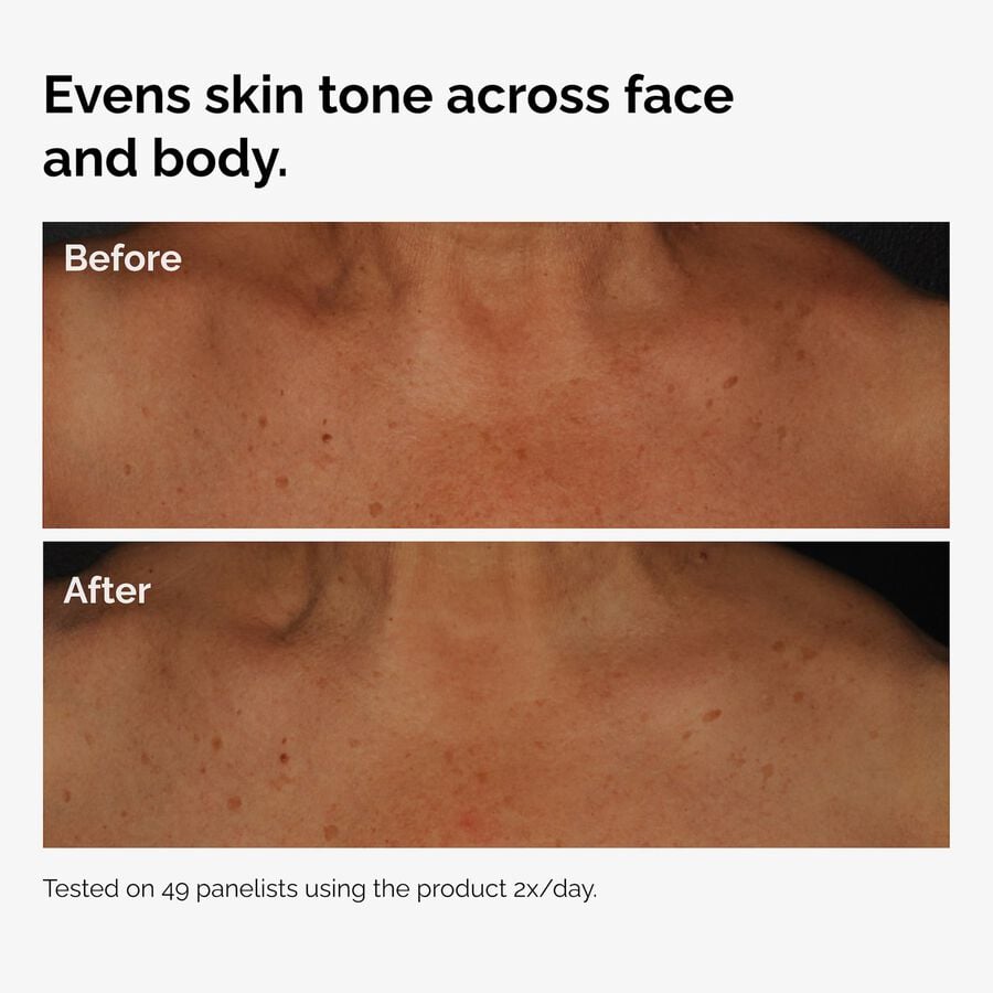 the-body-care-collection-u9 ord-niacinamide-face-body-serum-before-after-even-tone-graphic.jpg