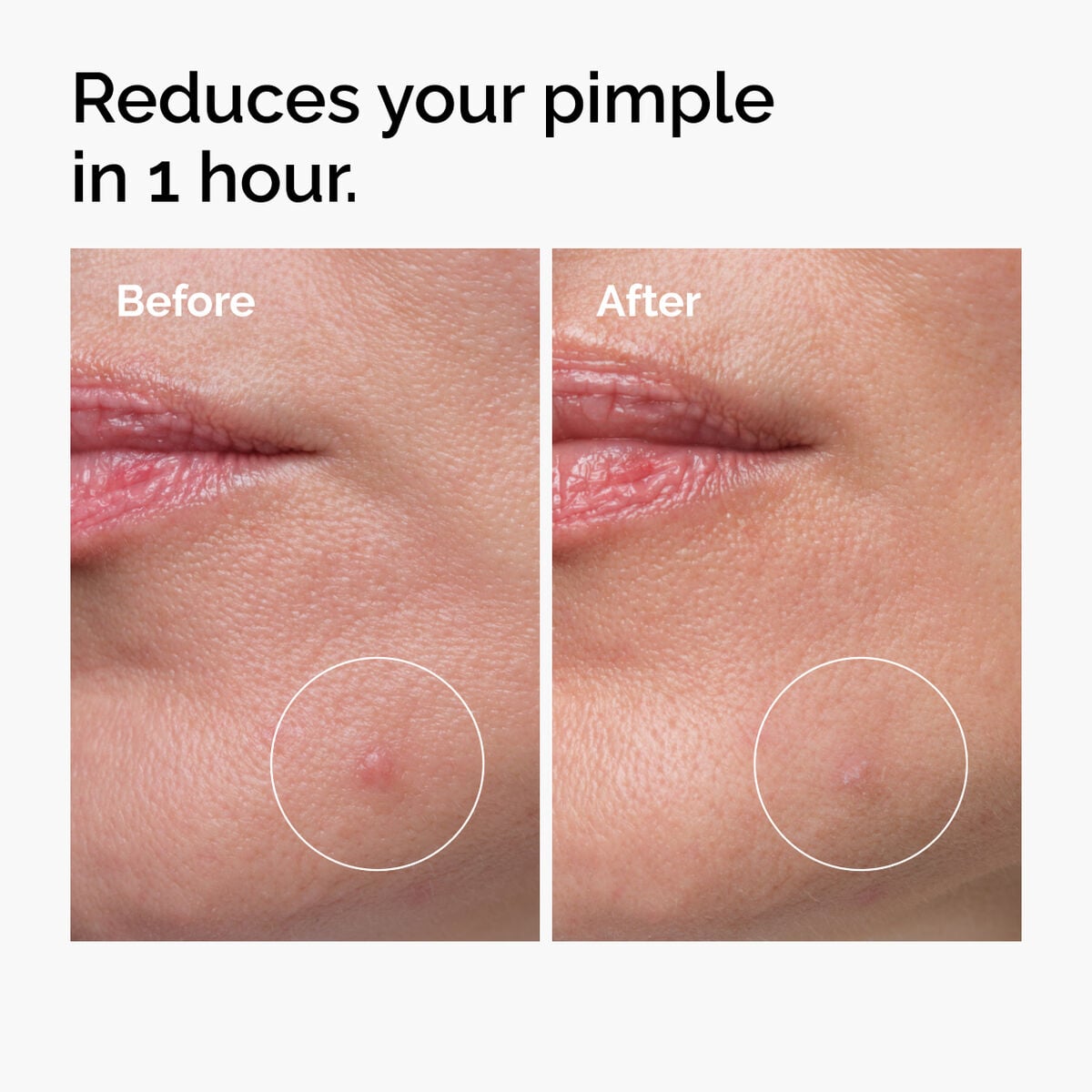 sulfur-10-powder-to-cream-concentrate-p7 ord-sulfur-10pct-powder-to-cream-concentrate-before-after-NA.jpg